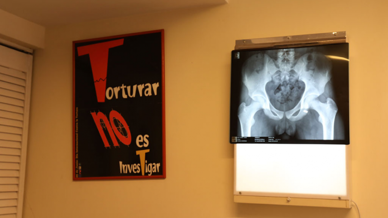 La radiografía del herido José Manuel Cono Itusaca, realizada en el ITEI.