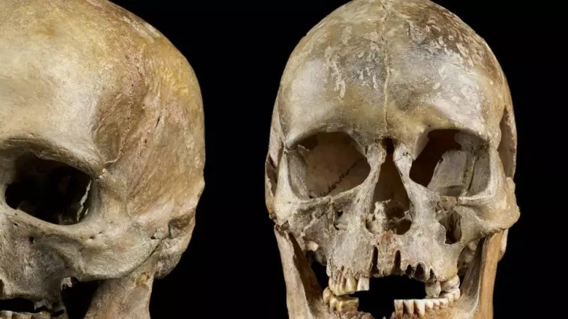 dos cráneos masculino y femenino enterrado en el oeste de Alemania