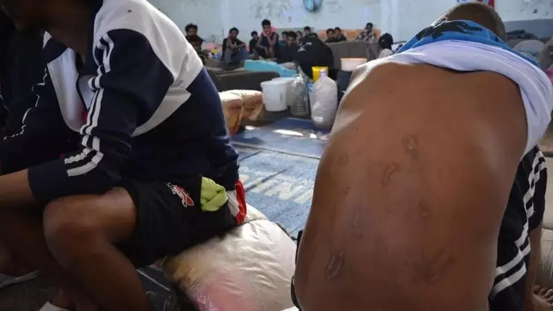 Una personas migrantes muestra signos de tortura en un centro de detención de Libia, en una imagen de 2019.