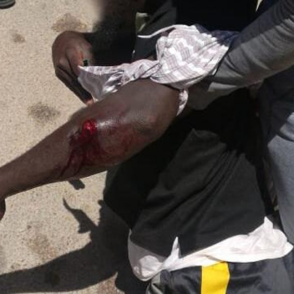Una personas de orgen subsahariano, herida durante enfrentamientos con la policía Marroquí en El Aaiún, en le Sáhara ocupado por Marruecos.-EQUIPE MEDIA