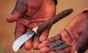 Otras miradas - Frenar otras pandemias: acabar con la mutilación genital femenina