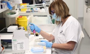 (31/5/22) Una técnico de laboratorio trabaja con pruebas PCR para la viruela del mono, a 31 de mayo de 2022.
