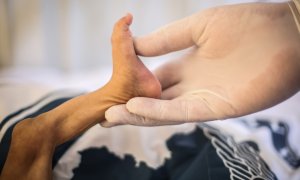 13/6/21 Una enfermera sujeta la pierna de un niño que sufre desnutrición aguda en un hospital de Idlib (Siria), a 13 de junio de 2021.