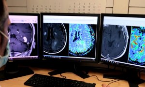 Un investigador mira ressonàncies magnètiques cerebrals en unes pantalles de l'Hospital de Bellvitge