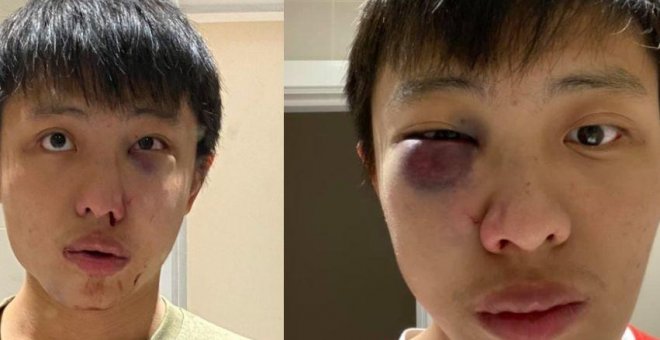 Un joven asiático sufre un ataque racista en Londres por el coronavirus