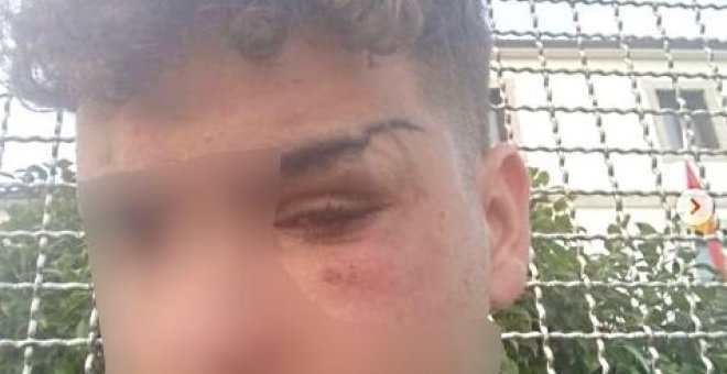 Un menor de edad denuncia que le dieron una paliza en Vilagarcía de Arousa por decir que era gay