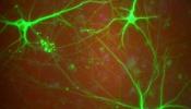 Las células madre mejoran la memoria en ratones