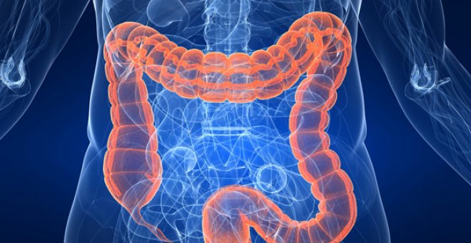 El 95% de los cánceres de colon tiene su origen en un 'simple' pólipo