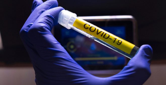 Sanidad registra 1.418 nuevos casos de COVID-19 en la última jornada