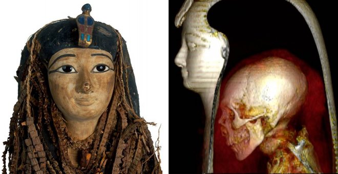 Un análisis por tomografía computarizada revela los secretos del faraón Amenhotep I