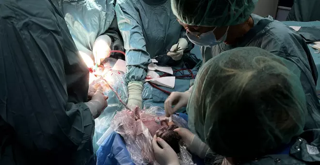 L'Hospital Sant Pau, pioner en aplicar una innovadora tècnica de reanimació en parts prematurs