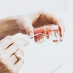 Dentista con implante dental