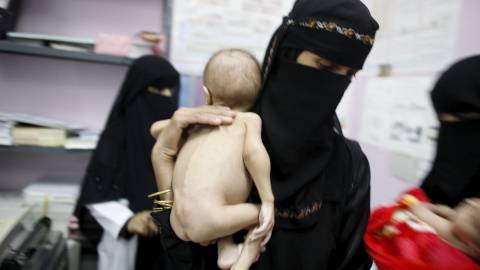 A woman holds her malnourished child at a malnutrition intensive care unit in Yemen's capital Sanaa April 6, 2016. REUTERS/Khaled Abdullah