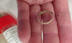 Un anillo aparecido en la exhumación de la fosa de las diez mujeres de Uncastillo.