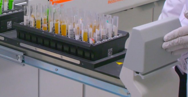 Fabricación en un laboratorio de tests de anticuerpos