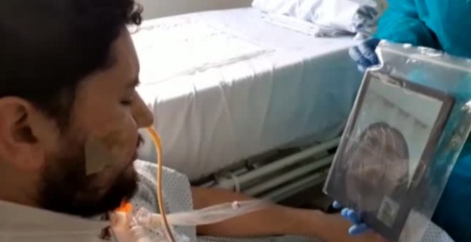 Los jóvenes no son inmunes: algunos sufren los efectos más graves del virus