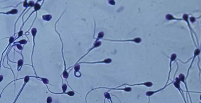 La calidad del semen varía entre ciudades: Granada y Oviedo, la peor y la mejor