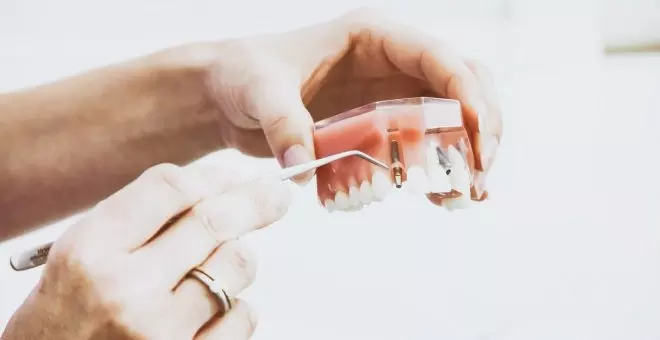 Implantes dentales: procedimiento, tipos y precios