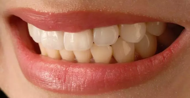 Cómo blanquear los dientes de forma natural